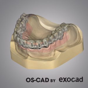 Opera System CAD by Exocad