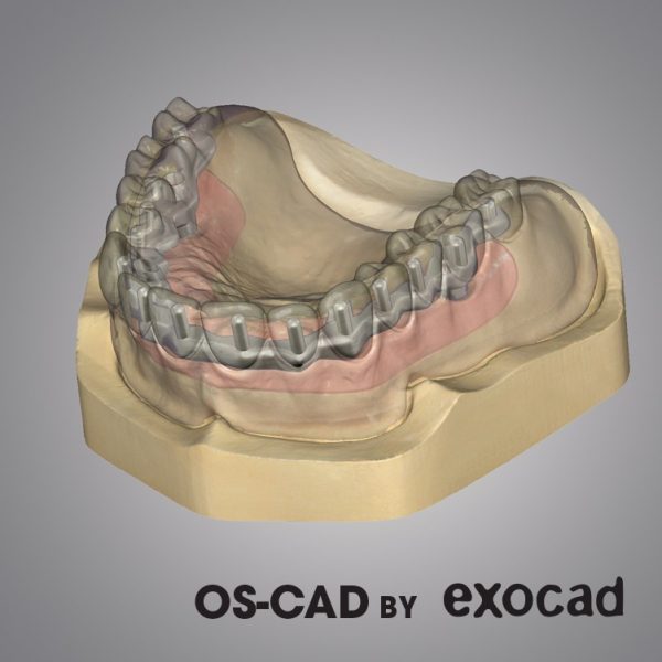 Opera System CAD by Exocad